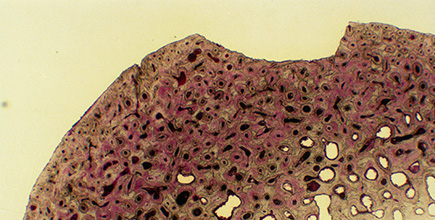Bone Cross Section