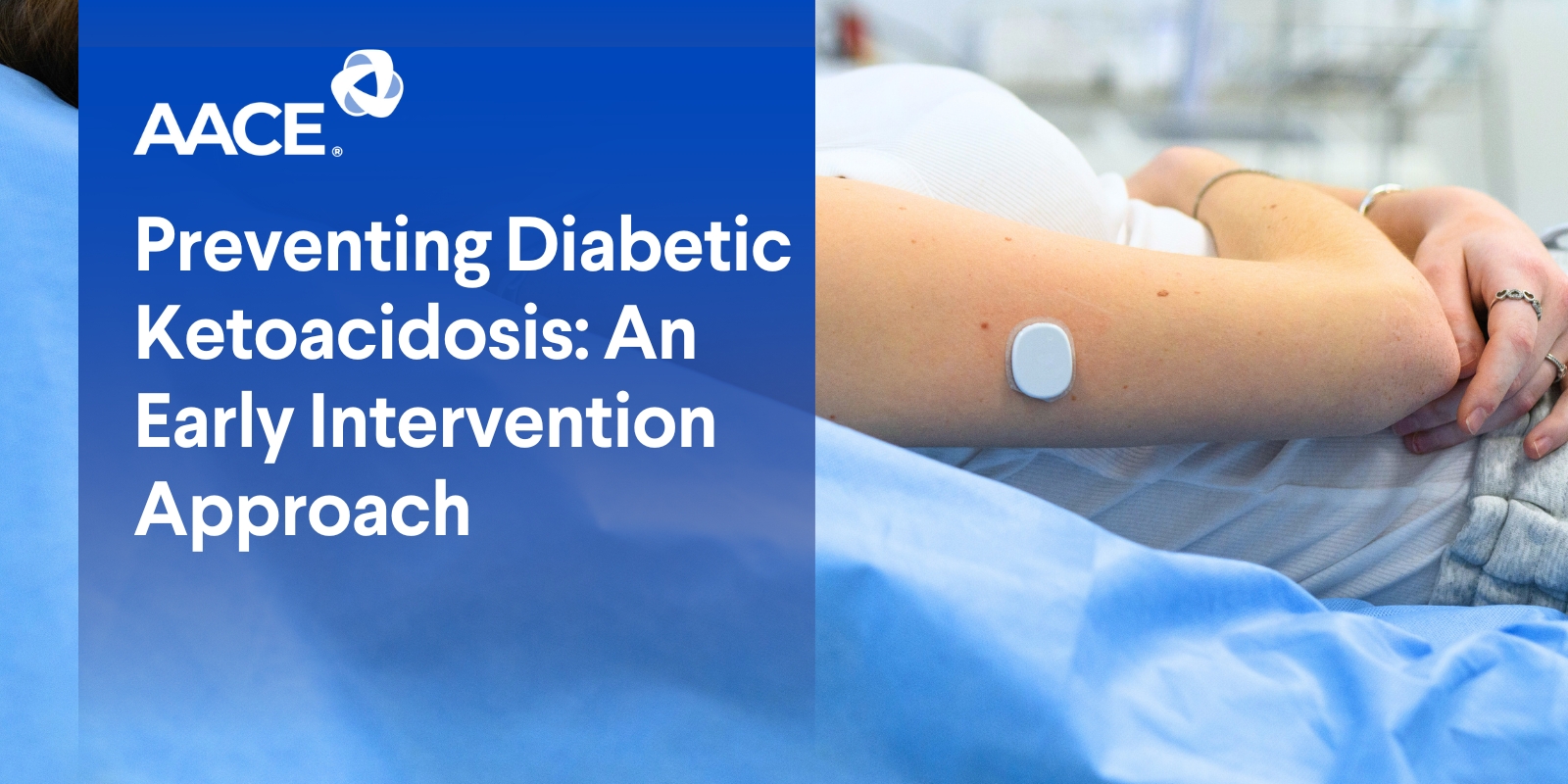 Preventing Diabetic Ketoacidosis: An Early Intervention Approach