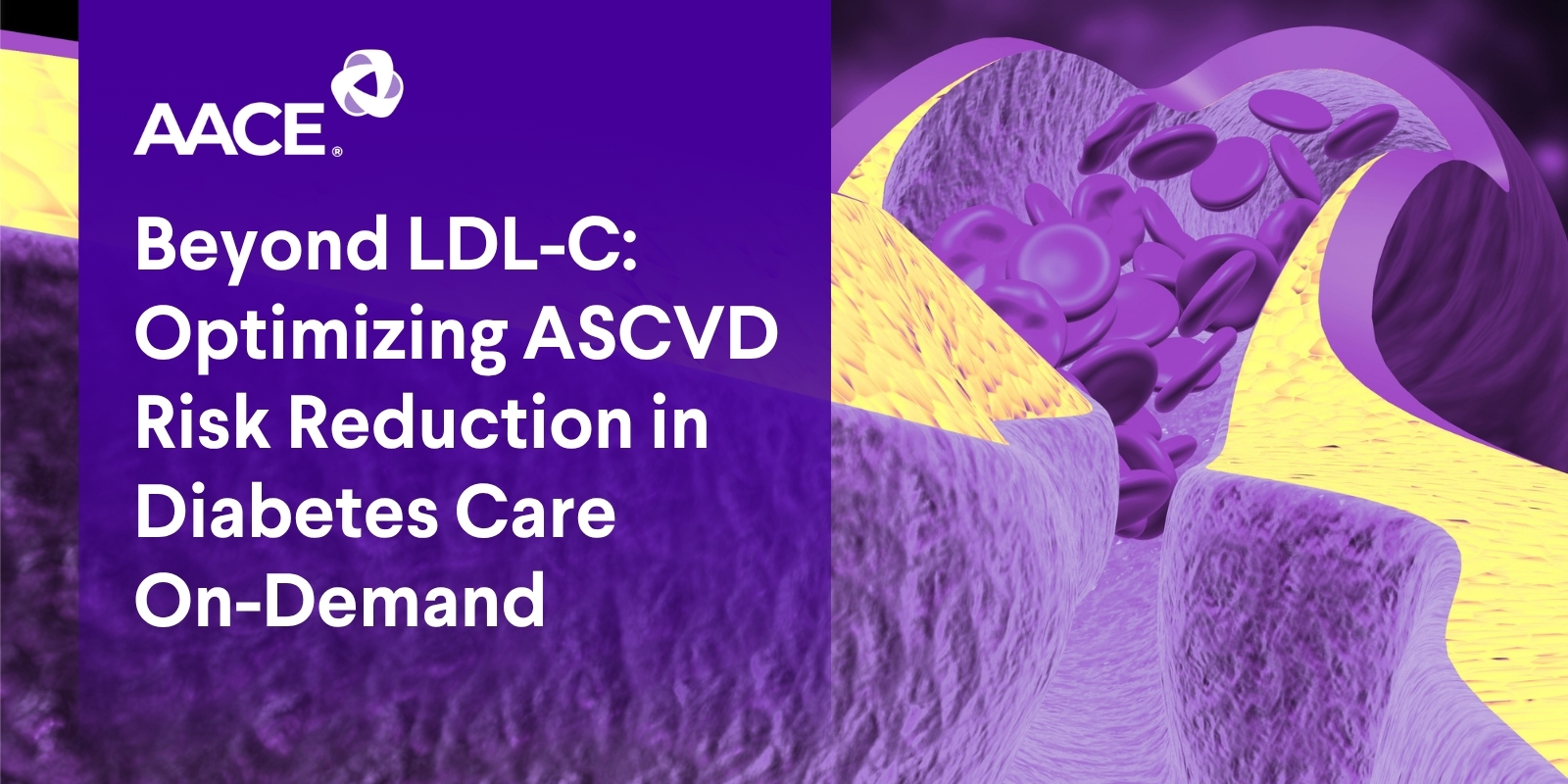 Beyond LDL-C: Optimizing ASCVD Risk Reduction in Diabetes Care On-Demand