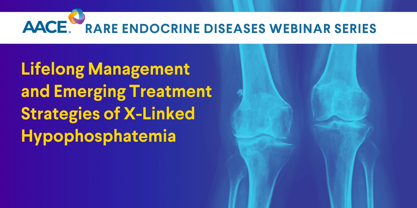 Lifelong Management and Emerging Treatment Strategies of X-Linked Hypophosphatemia